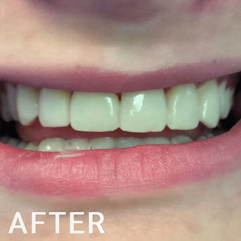 Close-up of a smiling mouth