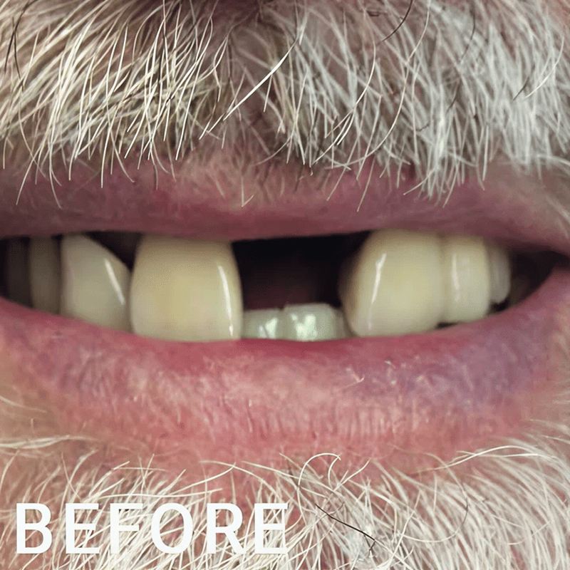 Before dental treatment smile
