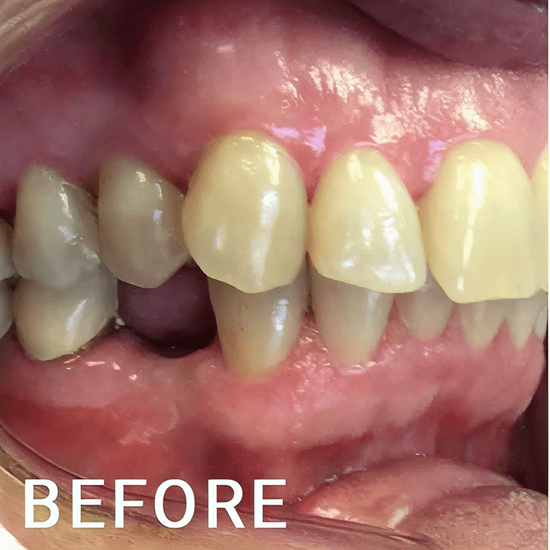 Close-up of yellowed teeth