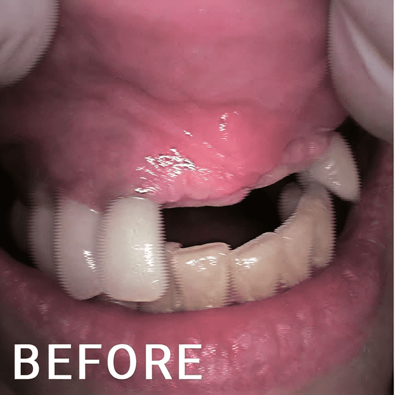 Close-up of upper gums and teeth